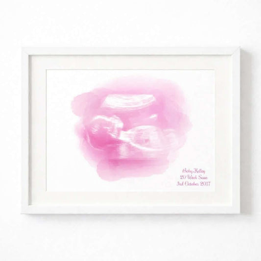 Personalised Baby Scan Wall Art